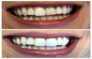 When To Look For Best Dental Services Near Me