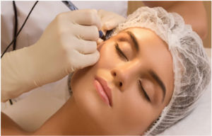 Laser treatment for acne and other skin diseases