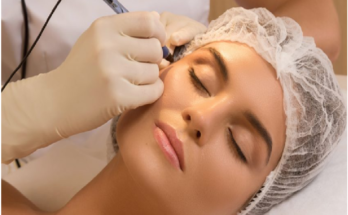 Laser treatment for acne and other skin diseases
