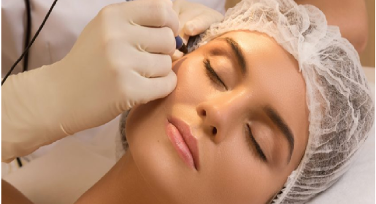 Laser treatment for acne and other skin diseases