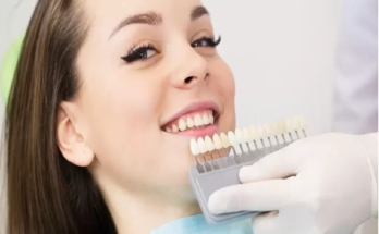 cosmetic dentistry Los Angeles