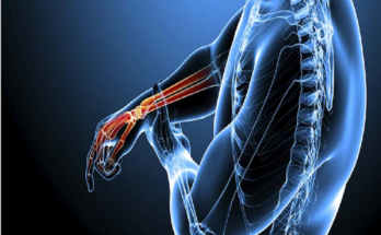 Trusted Orthopedic Doctors