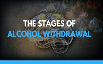 Alcohol Withdrawal and Seizures