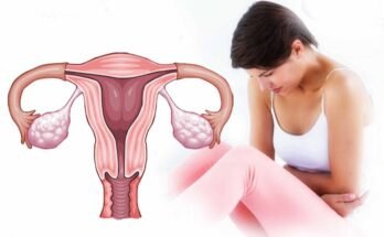 uterine issues