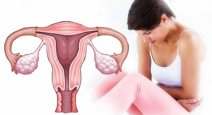 uterine issues